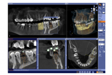 Radiologie Dentara Focsani Radiologie Dentara Focsani -  SANDENT