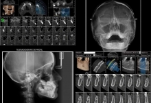 Radiologie Dentara Focsani Radiologie Dentara Focsani -  SANDENT