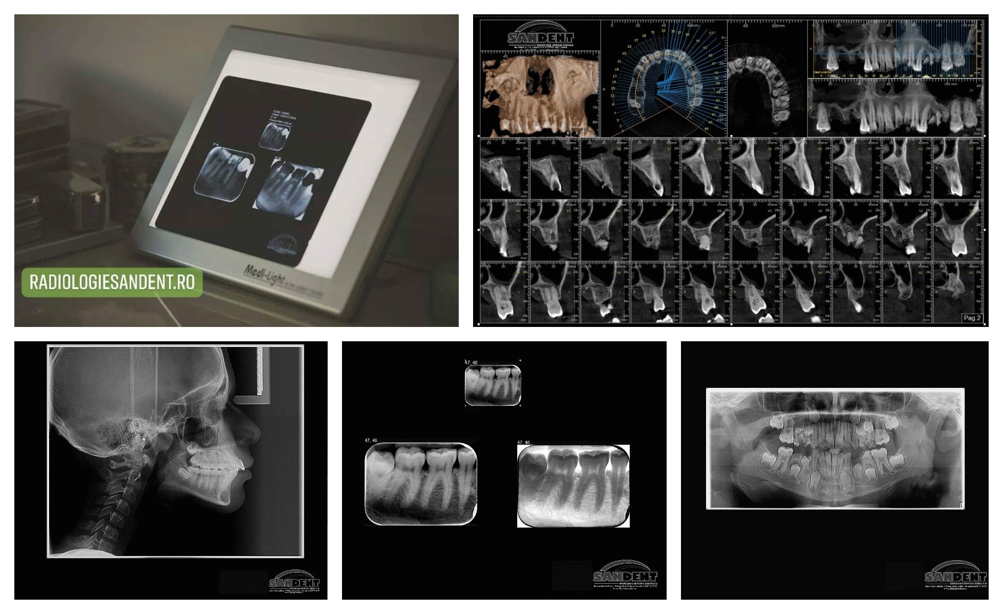 radiologie-dentara-focsani