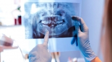 Radiologie Dentara Iasi
