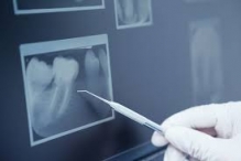 Radiologie Dentara Buzau