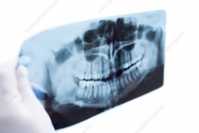 Radiologie Dentara Sighisoara