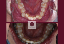 Radiologie Dentara Buftea Clinica Stomatologica si Radiologie Dentara Buftea - OKTO DENT