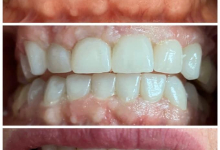 Radiologie Dentara Buftea Clinica Stomatologica si Radiologie Dentara Buftea - OKTO DENT