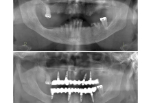 Radiologie Dentara Buftea Clinica Stomatologica si Radiologie Dentara Buftea - OKTO DENT