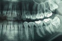 Radiologie Dentara Resita Cabinet Stomatologic Oravita - Dr. Zaharia Valentin