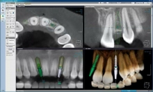 Radiologie Dentara Focsani Radiologie Dentara Focsani -  SANDENT