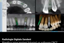 Radiologie Dentara Focsani Radiologie Dentara Focsani -  SANDENT