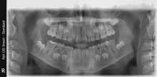 Radiologie Dentara Rupea Radiologie Dentara Rupea - Diodenta TopRadyx 