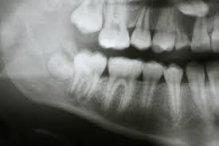 Radiologie Dentara Tecuci Radiologie Dentara Tecuci - PanoramicRx