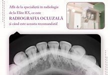 Radiologie Dentara Tutova Radiologie Dentara Tutova - Laborator Radiologie Elite RX