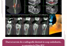 Radiologie Dentara Tutova Radiologie Dentara Tutova - Laborator Radiologie Elite RX