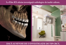 Radiologie Dentara Zorleni Radiologie Dentara Zorleni - Laborator Radiologie Elite RX