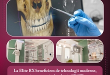 Radiologie Dentara Zorleni Radiologie Dentara Zorleni - Laborator Radiologie Elite RX