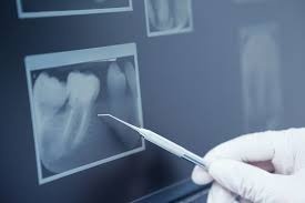 radiologie radiografii dentare barlad